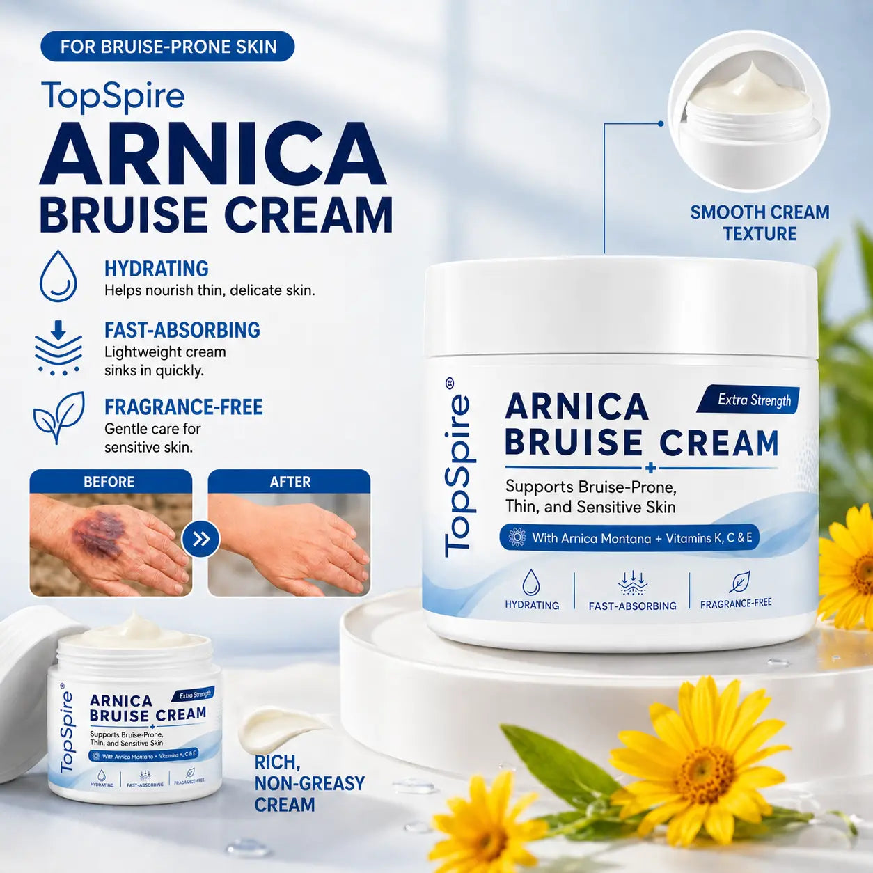 TopSpire® Arnica Bruise Cream