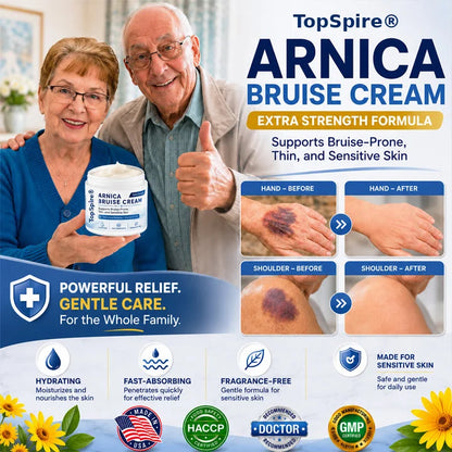 TopSpire® Arnica Bruise Cream