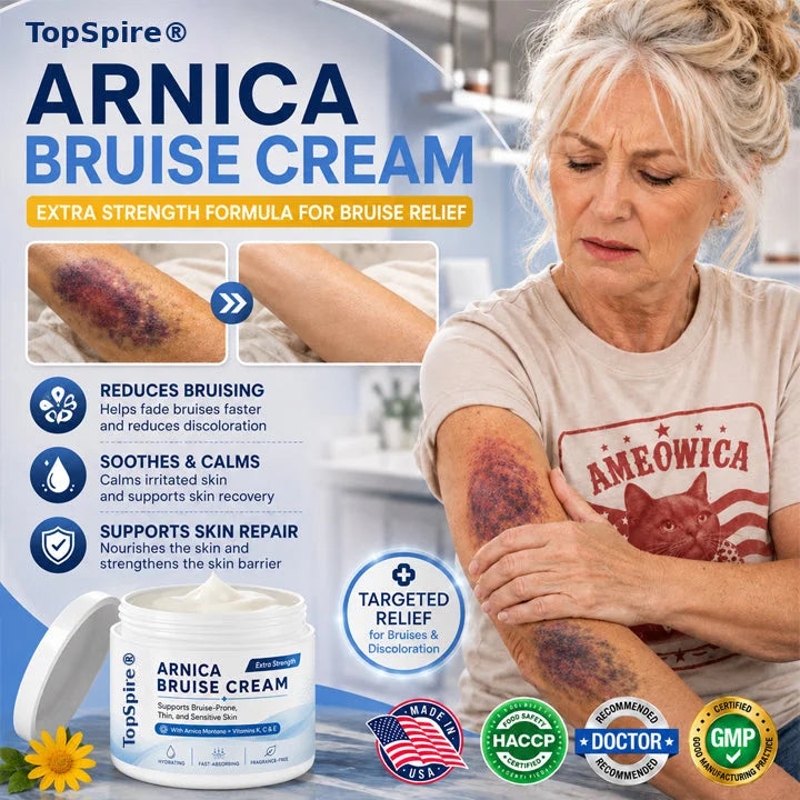 TopSpire® Arnica Bruise Cream