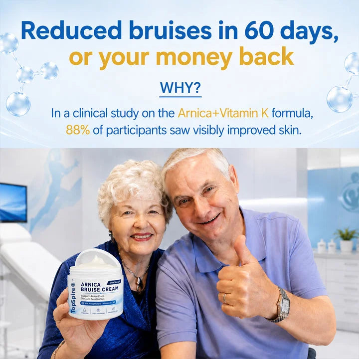 TopSpire® Arnica Bruise Cream