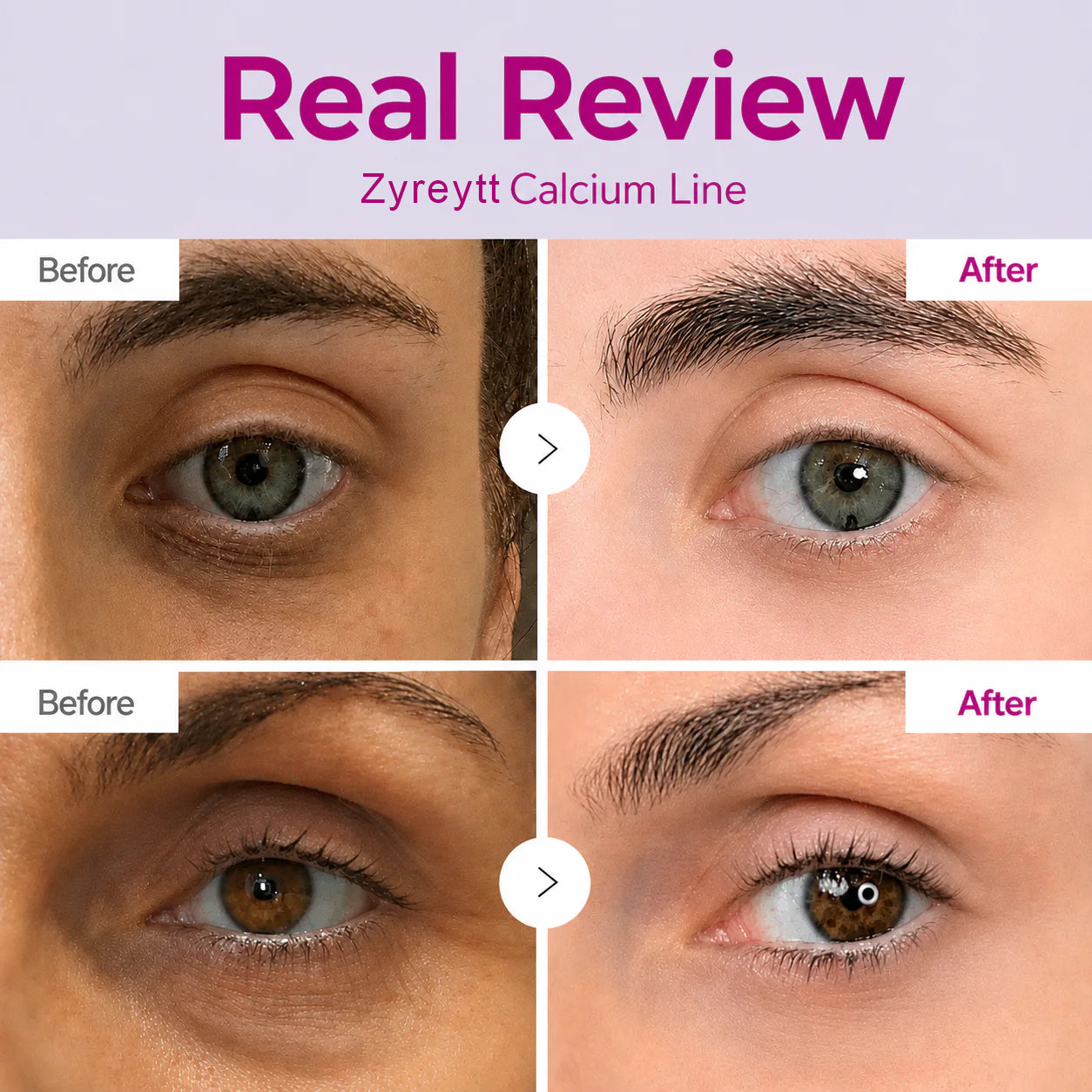 🔥LAST DAY 50% OFF!! Korean Calcium Dark Spot Eye Cream