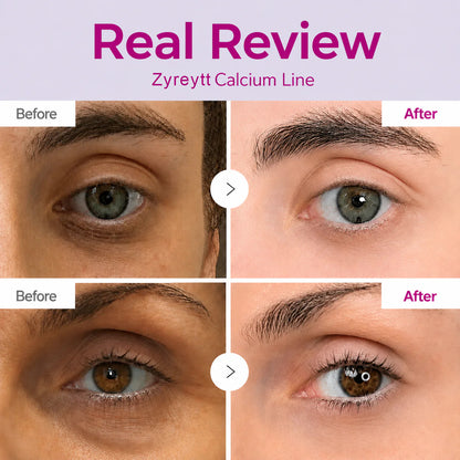 🔥LAST DAY 50% OFF!! Korean Calcium Dark Spot Eye Cream