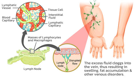 Lymphatic capillaries and lymphatic system diagram