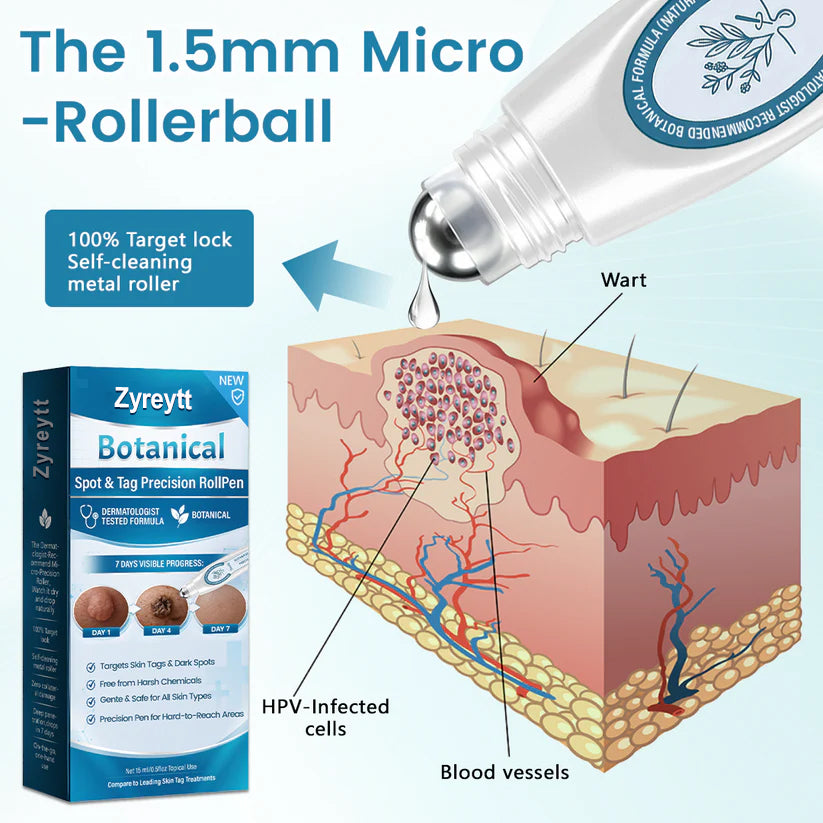 Zyreytt® Botanical Spot & Tag Precision RollPen