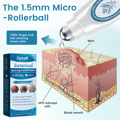 Zyreytt® Botanical Spot & Tag Precision RollPen
