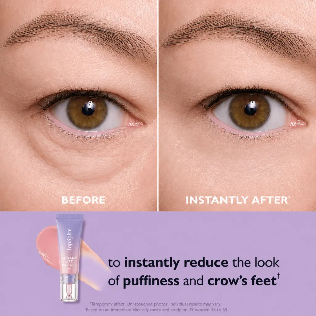 TopSpire Eye Bag Instant Eraser, Tightens, Firms, & Blurs Wrinkles