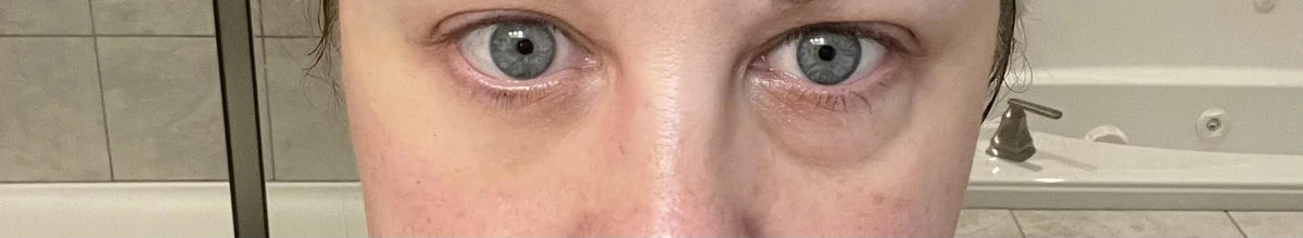 Fempick eye gel before makeup image