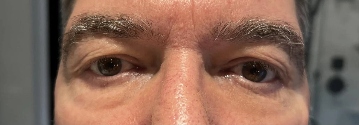 Fempick eye gel texture image