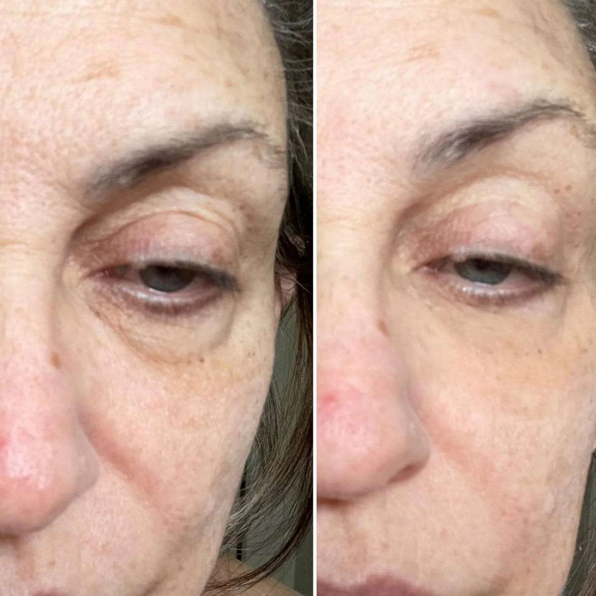 Fempick eye gel close-up product image