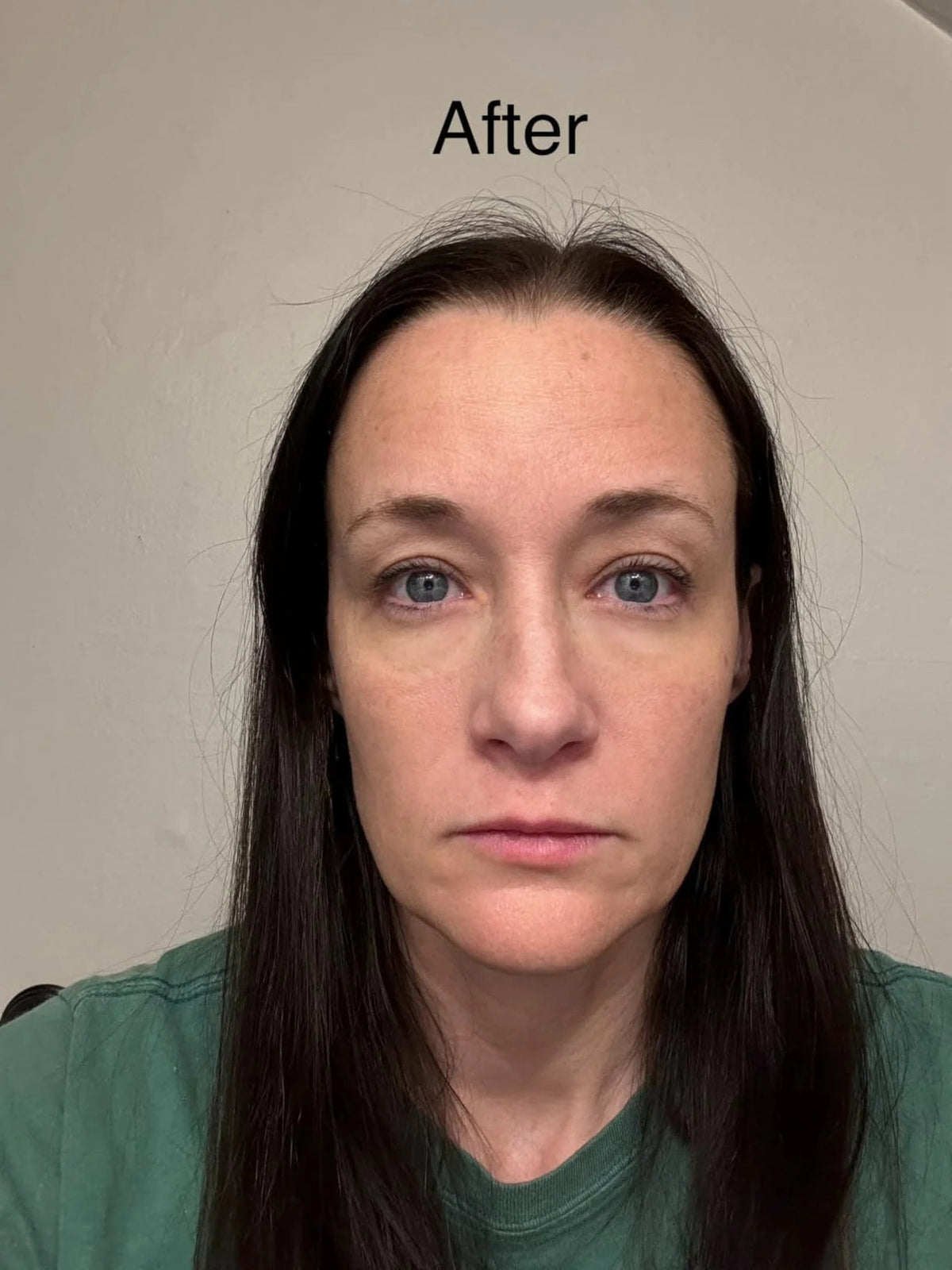 Fempick firming eye gel routine image
