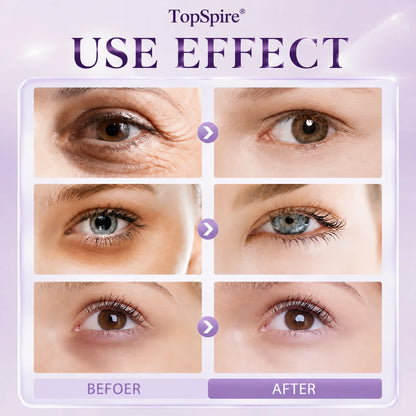 TopSpire 60 Second Effects Tinted Firming Gel - Under Eye Cream For Puffiness And Bags Under Eyes