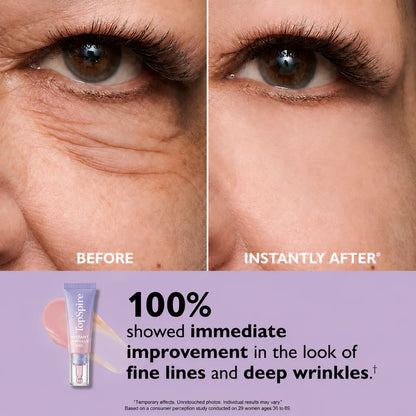 TopSpire Eye Bag Instant Eraser, Tightens, Firms, & Blurs Wrinkles