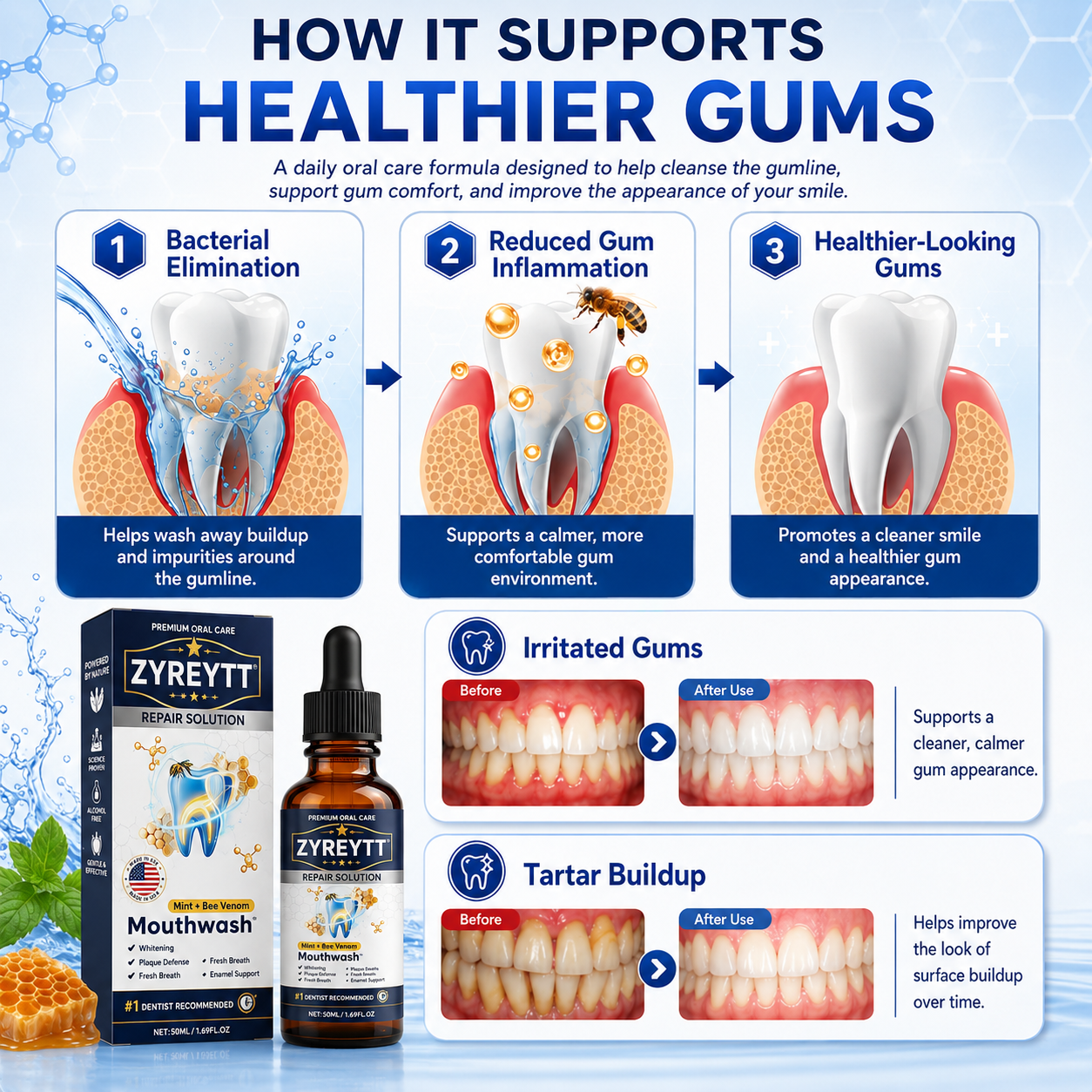 Zyreytt® Oral Repair Solution 🦷 — Inspired Mouthwash for Gumline Care, Plaque Defense & Fresher Breath