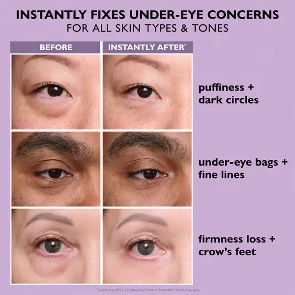 TopSpire Eye Bag Instant Eraser, Tightens, Firms, & Blurs Wrinkles