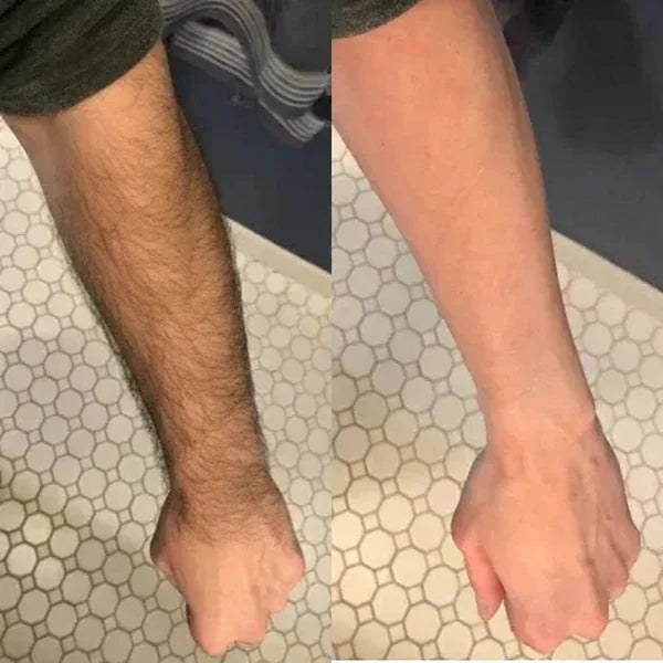 ZYREYTT Pain-Free Hair Removal Cream