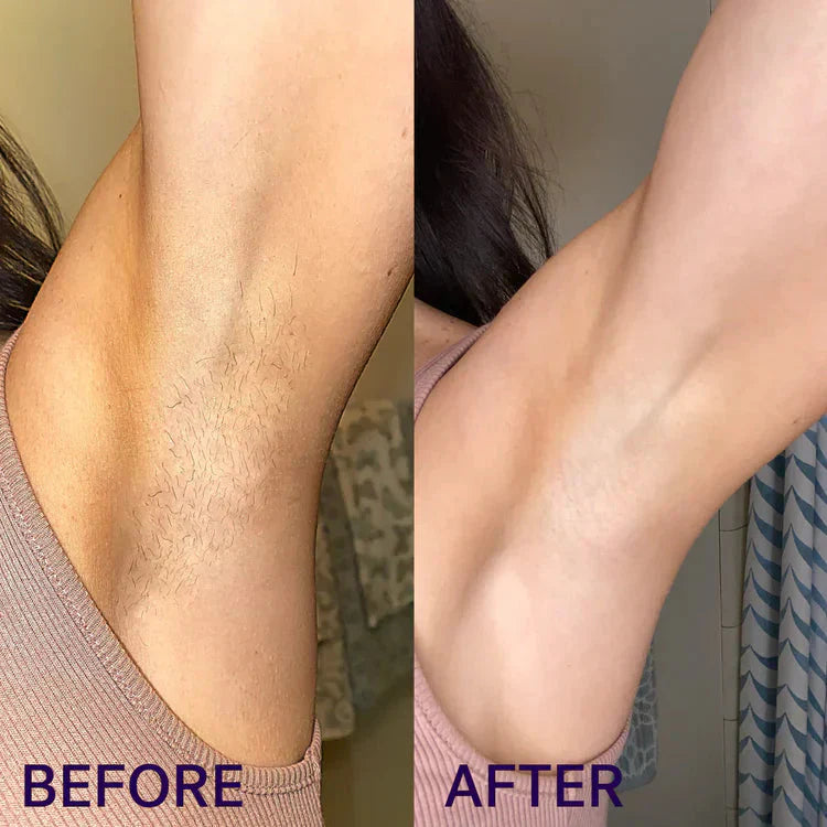 ZYREYTT Pain-Free Hair Removal Cream