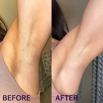 ZYREYTT Pain-Free Hair Removal Cream