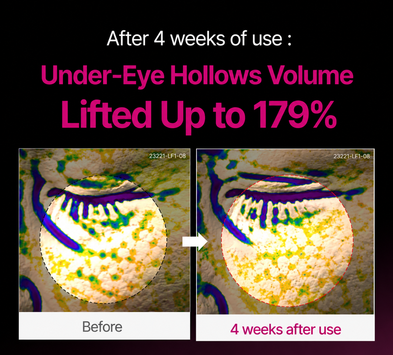 🔥LAST DAY 50% OFF!! Korean Calcium Dark Spot Eye Cream